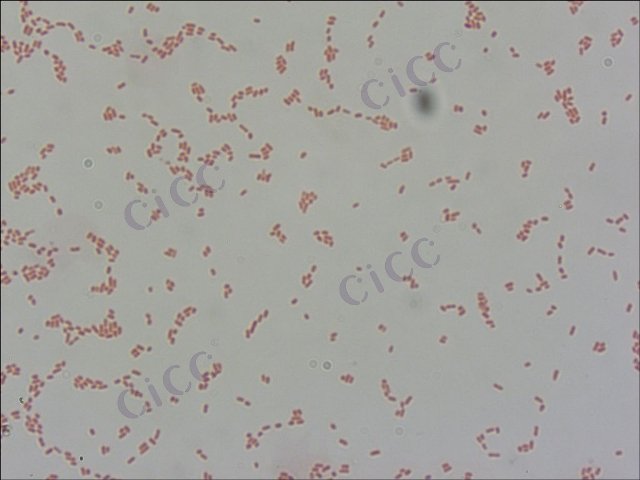 Cronobacter sakazakii
