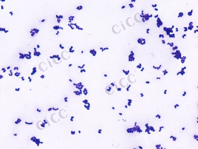 Corynebacterium glutamicum