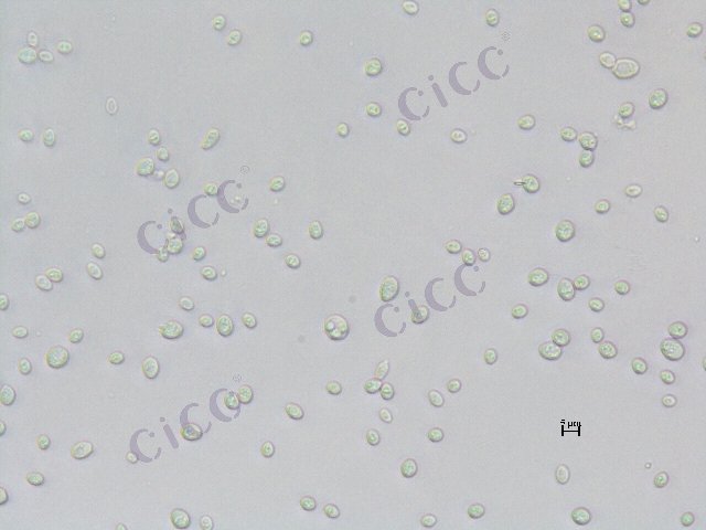 Saccharomyces cerevisiae