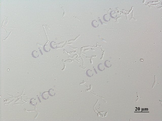 Rhodotorula mucilaginosa