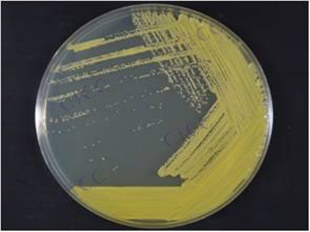 Micrococcus lylae