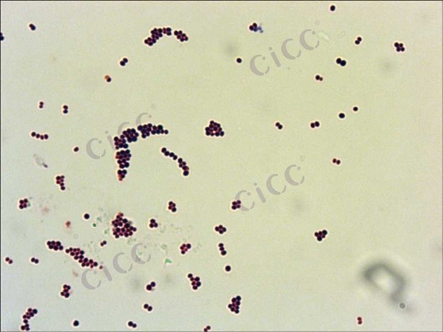 金黄色葡萄球菌 Staphylococcus aureus CICC 10145 Staphylococcus aureus