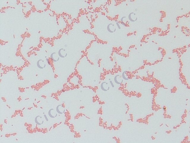 Salmonella enterica subsp enterica serovar Dublin