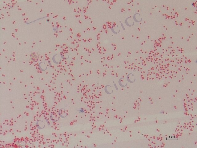 Acinetobacter haemolyticus/genospecies 4