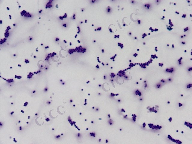 Staphylococcus warneri
