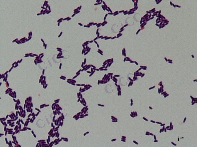 Ligilactobacillus salivarius