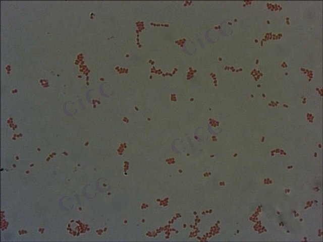 Enterobacter cloacae