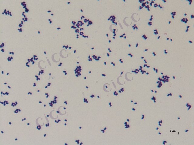 Corynebacterium glutamicum