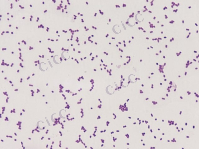 Salmonella enterica subsp enterica serotype Wandsworth