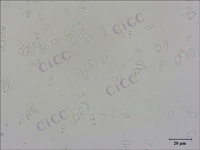 Saccharomyces cerevisiae