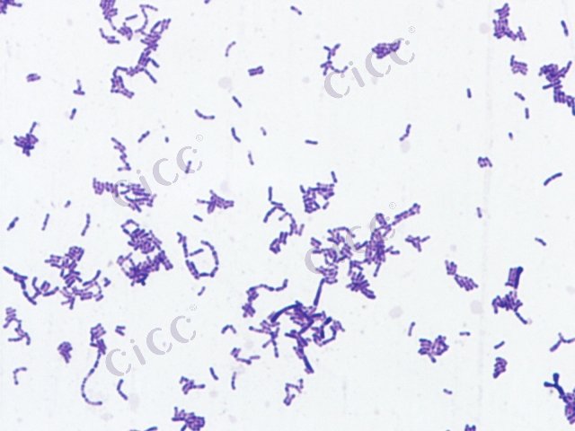 Bifidobacterium adolescentis