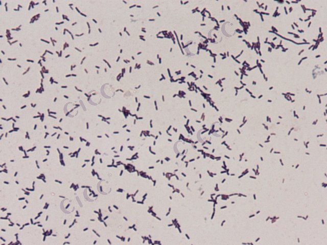 Listeria grayi