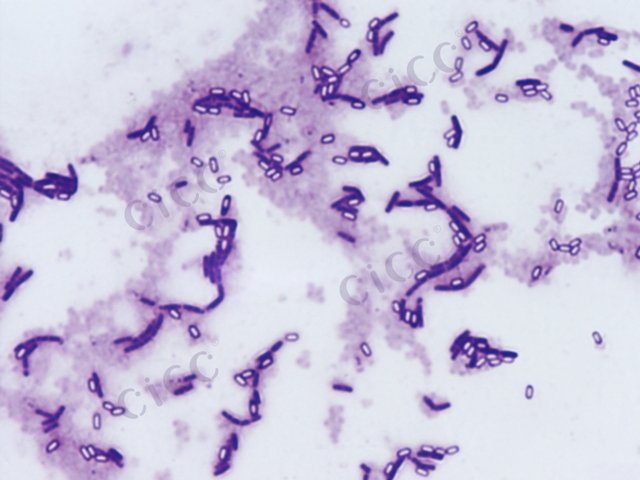 Bacillus subtilis subsp subtilis