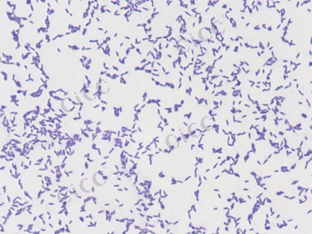 Pseudomonas aeruginosa