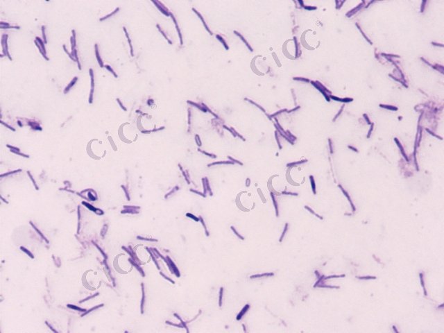 Anoxybacillus sp