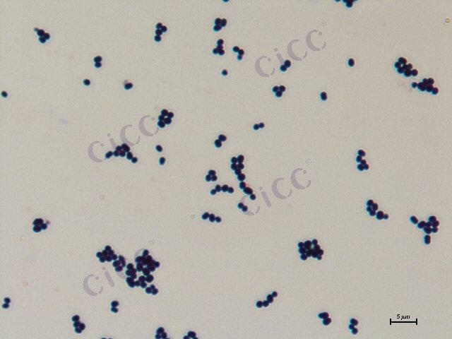 Corynebacterium ammoniagenes