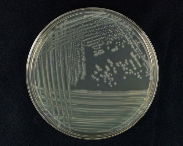 Alcaligenes faecalis subsp faecalis