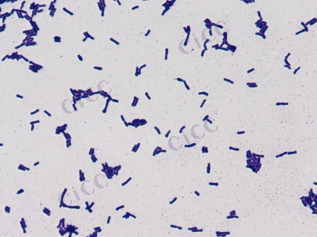 Bifidobacterium animalis subsp lactis