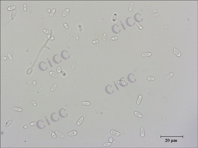 Sporidiobolus salmonicolor