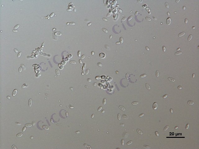 Pichia occidentalis