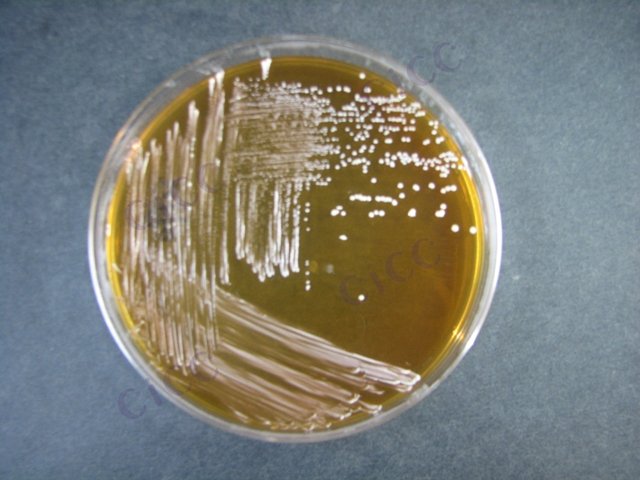 Lactiplantibacillus plantarum