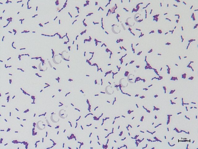 Lacticaseibacillus rhamnosus