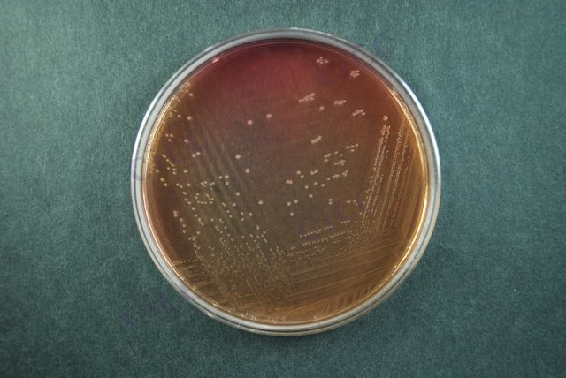 福氏志贺氏菌 Shigella flexneri CICC 21534 Shigella flexneri