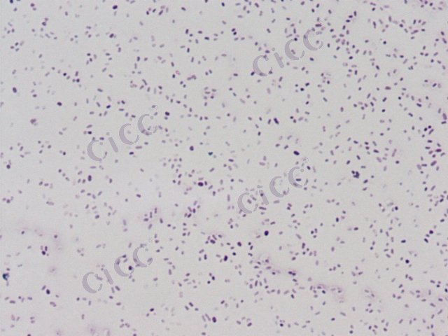 Serratia marcescens subsp sakuensis