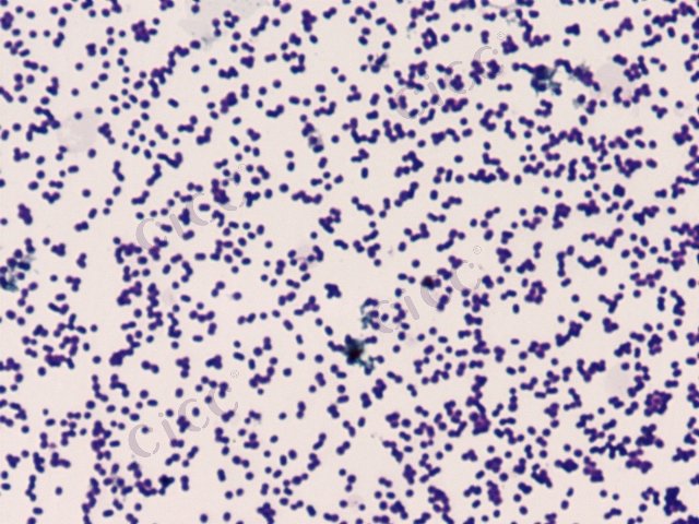 Acinetobacter sp