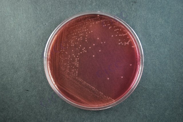 鲍氏志贺氏菌 Shigella boydii CICC 21680 Shigella boydii