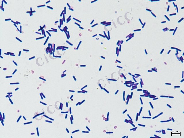 Lysinibacillus sp