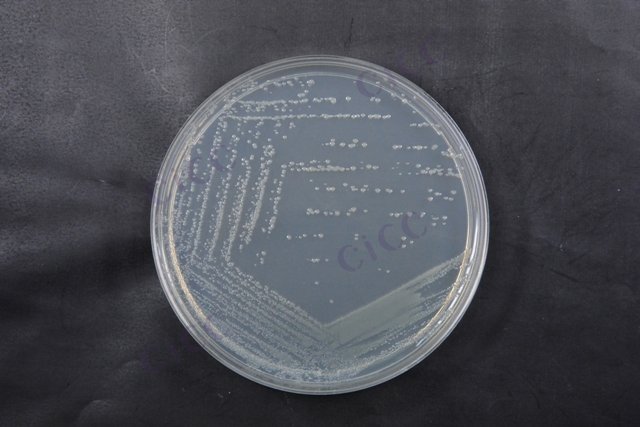 肠道出血性大肠埃希氏菌 Escherichia coli EHEC CICC 24187 Escherichia coli EHEC