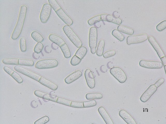 Magnusiomyces magnusii