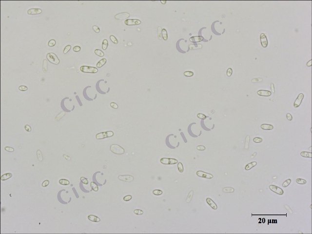 Saccharomyces cerevisiae