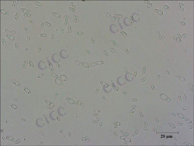 Saccharomyces cerevisiae