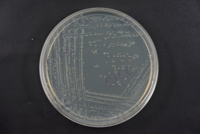 福氏志贺氏菌 Shigella flexneri CICC 10865 Shigella flexneri