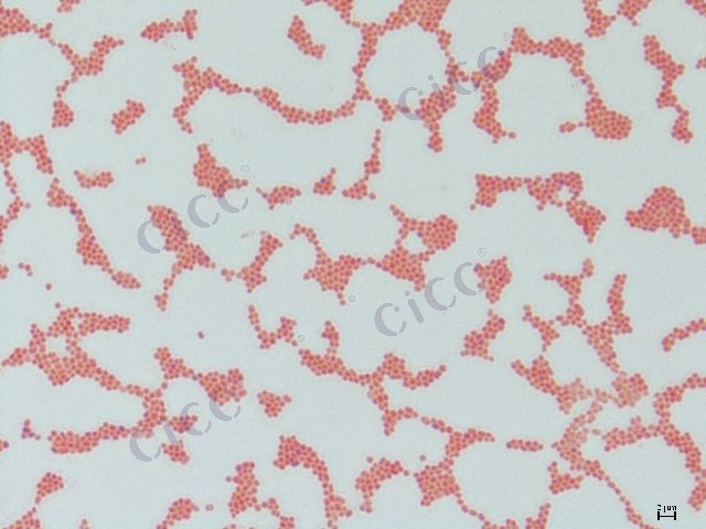 Klebsiella oxytoca