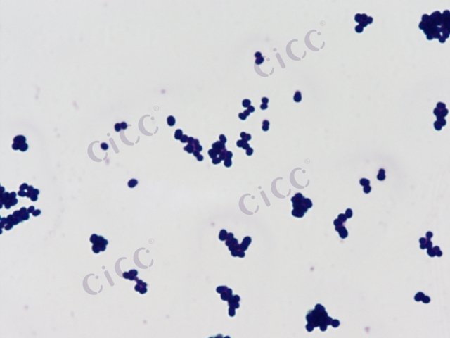 Corynebacterium guangdongense