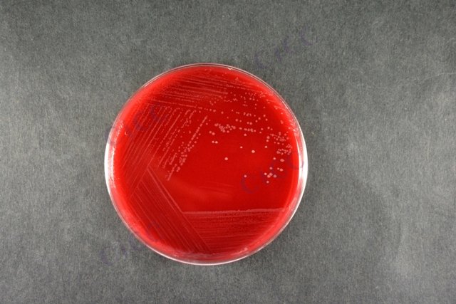 Campylobacter jejuni subsp jejuni