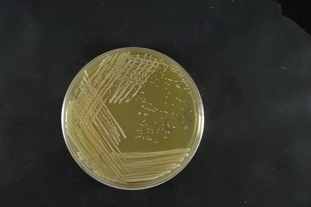 乳酸片球菌 Pediococcus acidilactici CICC 10346 Pediococcus acidilactici