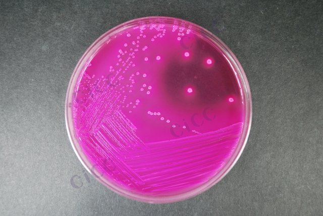肠道致病性大肠埃希氏菌 Escherichia coli EPEC CICC 10664 Escherichia coli EPEC