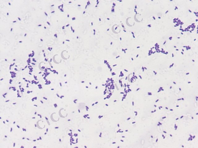 Pseudomonas fluorescens
