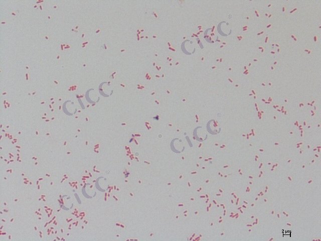 Pseudomonas aeruginosa