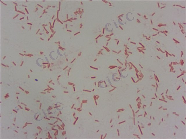 Salmonella enterica subsp enterica serovar Typhi