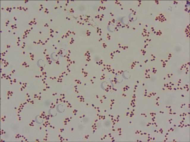 Acinetobacter pittii