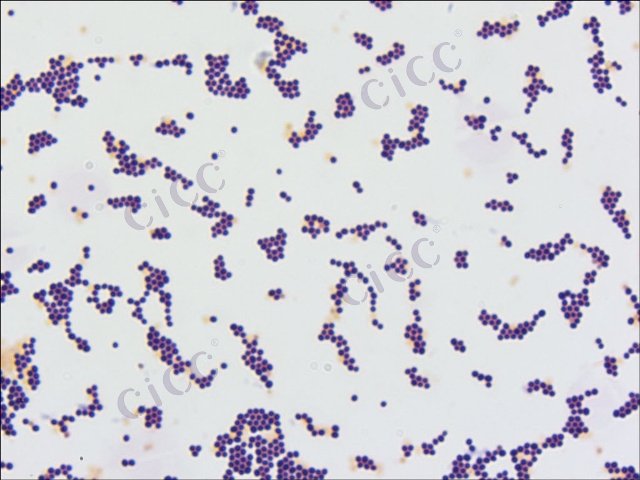 Staphylococcus saprophyticus subsp saprophyticus