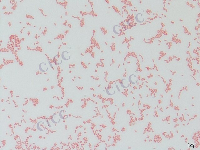 Salmonella enterica subsp enterica serovar Paratyphi-B