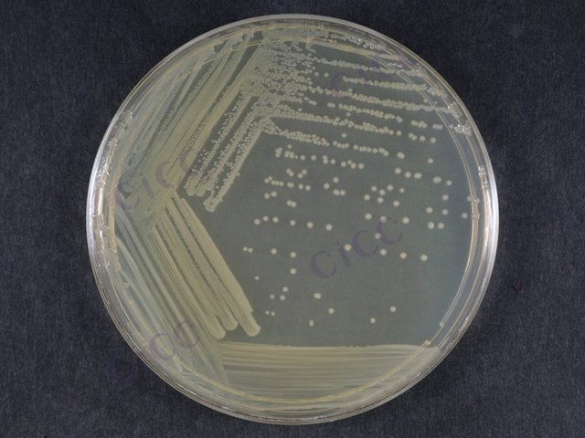 Yersinia enterocolitica