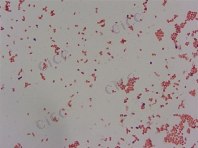 肠道致病性大肠埃希氏菌 Escherichia coli EPEC O 127 : K63 CICC 10411 Escherichia coli EPEC O 127 : K63