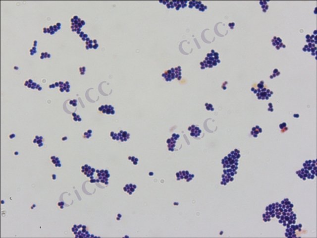 Pediococcus pentosaceus